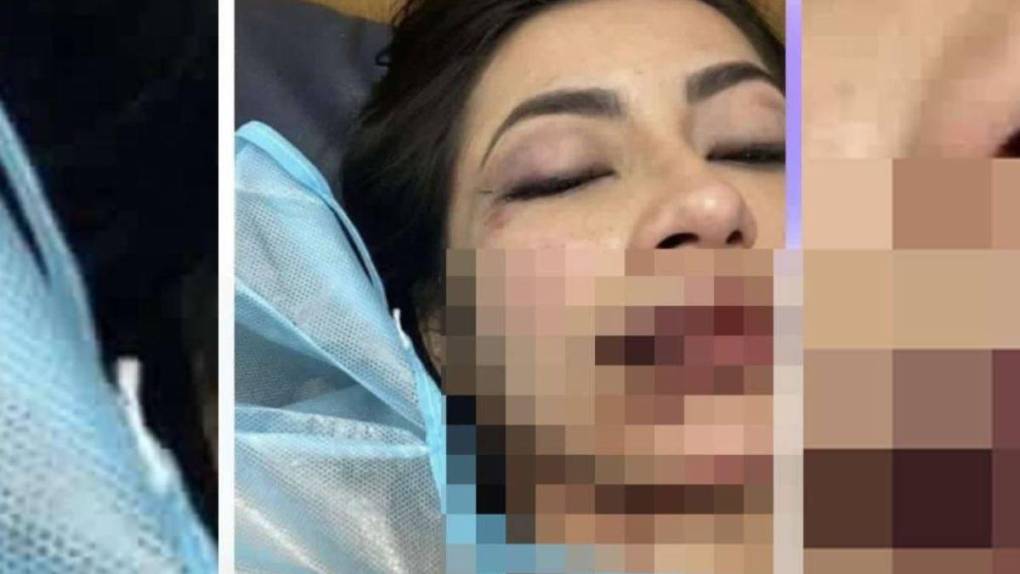 La golpeó y luego fue a denunciarla: lo más reciente sobre tiktoker colombiana agredida por su novio