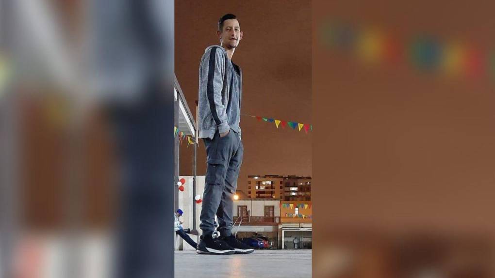 Muere joven de 19 años que fue quemada por su exnovio en una plaza pública de Perú