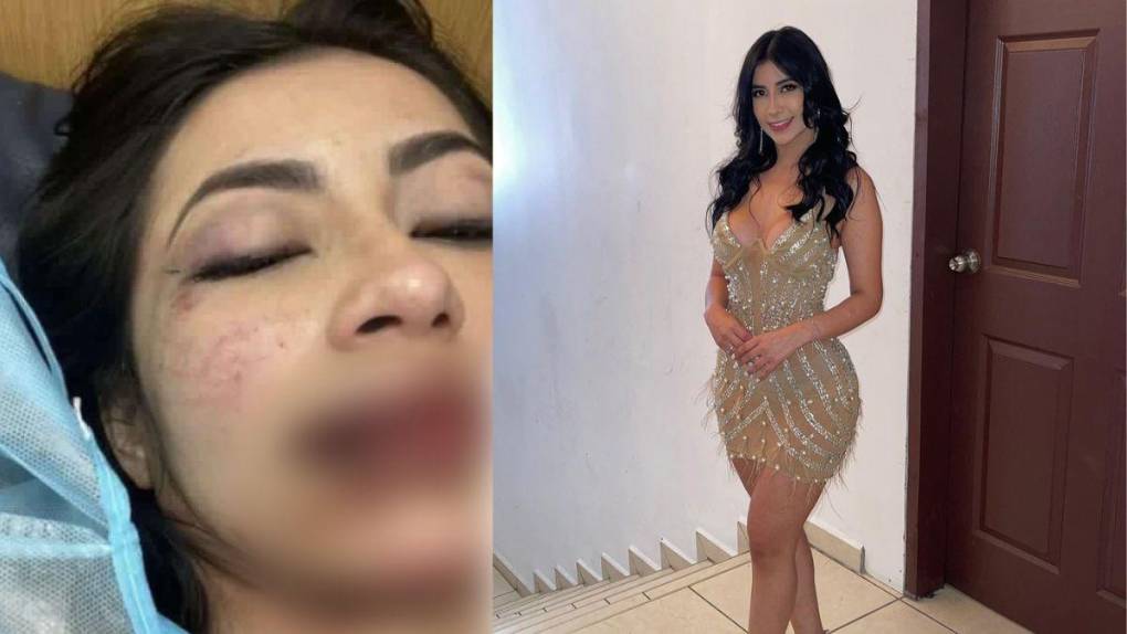 La golpeó y luego fue a denunciarla: lo más reciente sobre tiktoker colombiana agredida por su novio