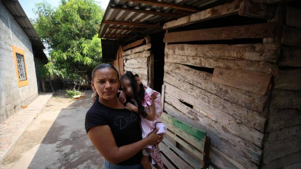 Los hijos del zika sobreviven en medio de la calamidad: las historias no contadas