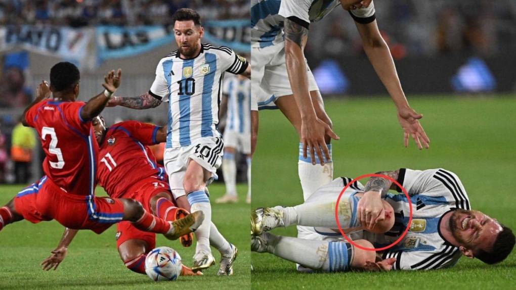 ¡Patada criminal! La terrible entrada que sufrió Messi en el Argentina - Panamá