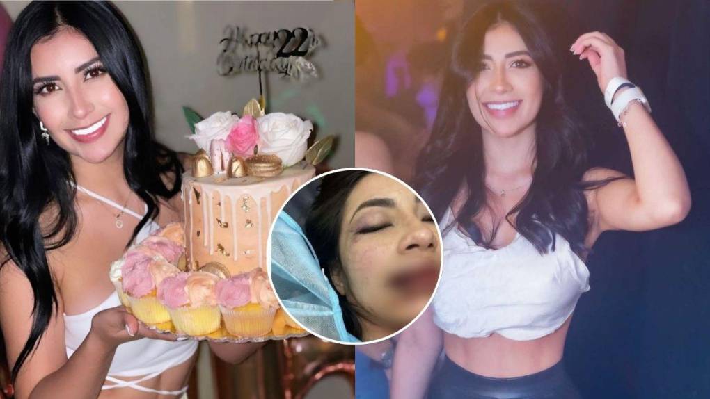 Modelo y Tiktoker: Así es Daniela Aldana, la colombiana que fue golpeada por su novio en San Pedro Sula