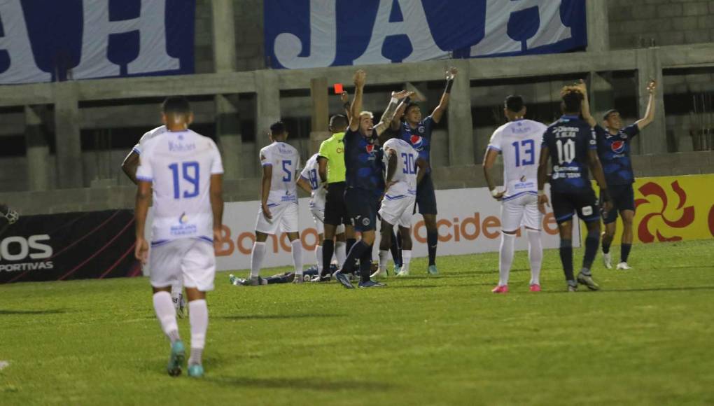 Carlos Argueta y la terrible lesión que sufrió en juego de Motagua