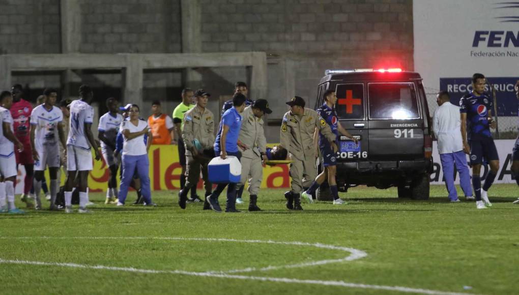 Carlos Argueta y la terrible lesión que sufrió en juego de Motagua