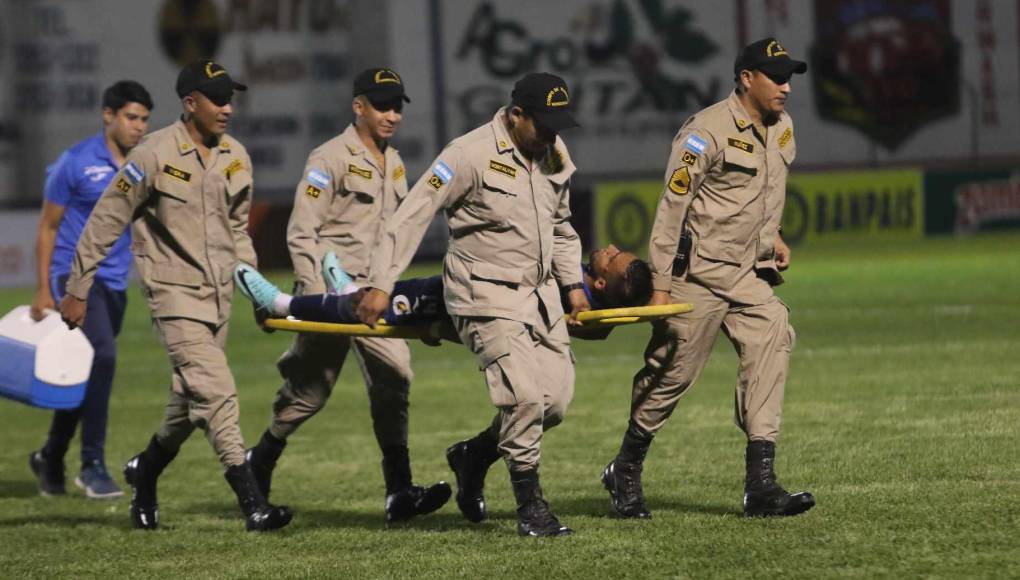 Carlos Argueta y la terrible lesión que sufrió en juego de Motagua