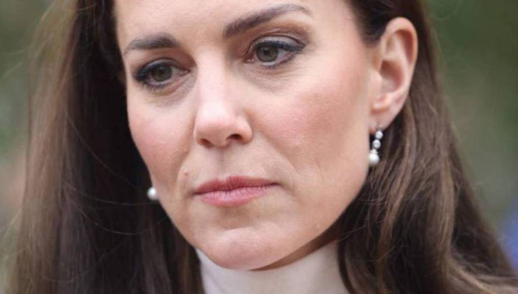 Kate Middleton se ausentaría más tiempo por una cirugía: ¿De qué se trata?