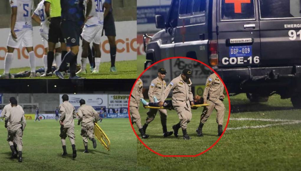 Carlos Argueta y la terrible lesión que sufrió en juego de Motagua