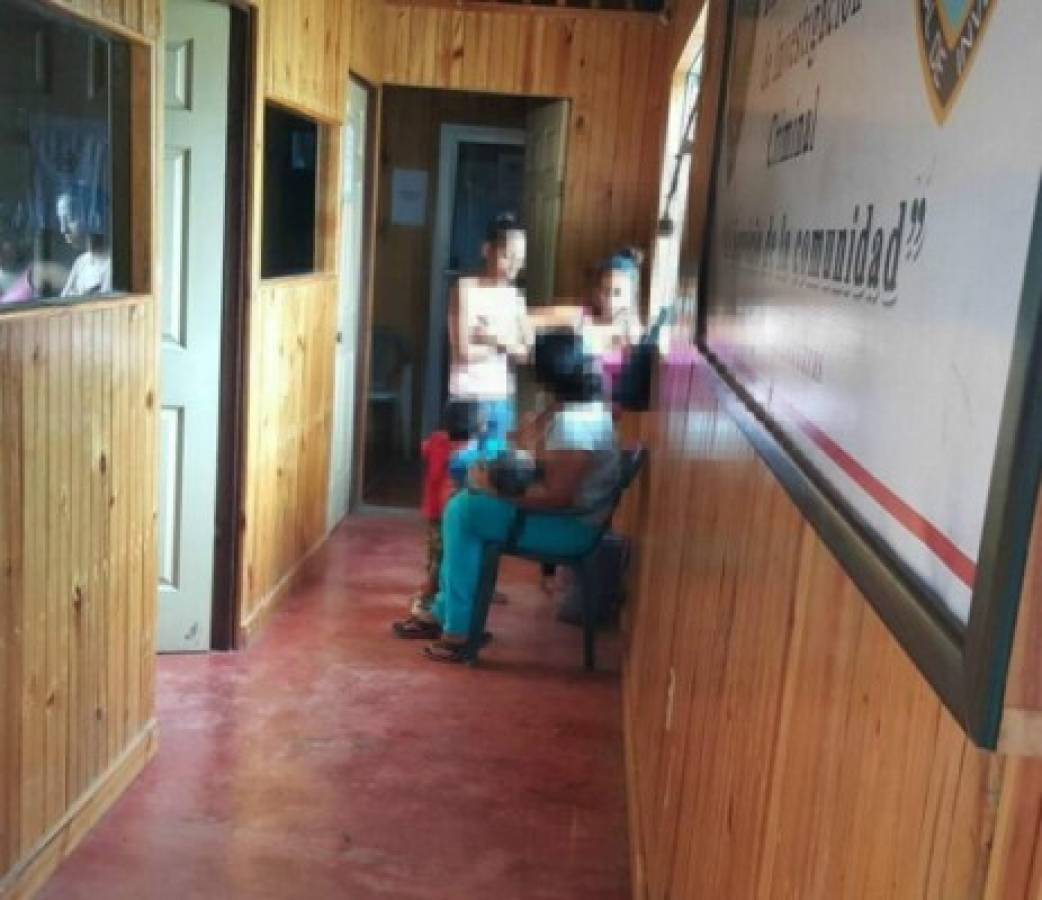 Honduras: Padrastro le quema la mano a niño en un fogón como castigo