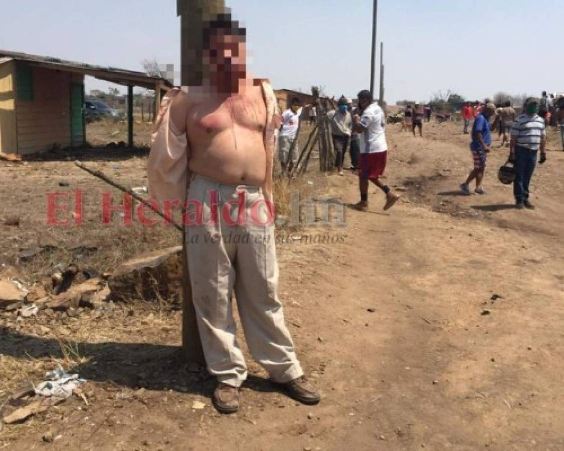 Atan y linchan a supuesto usurpador de tierras en aldea capitalina