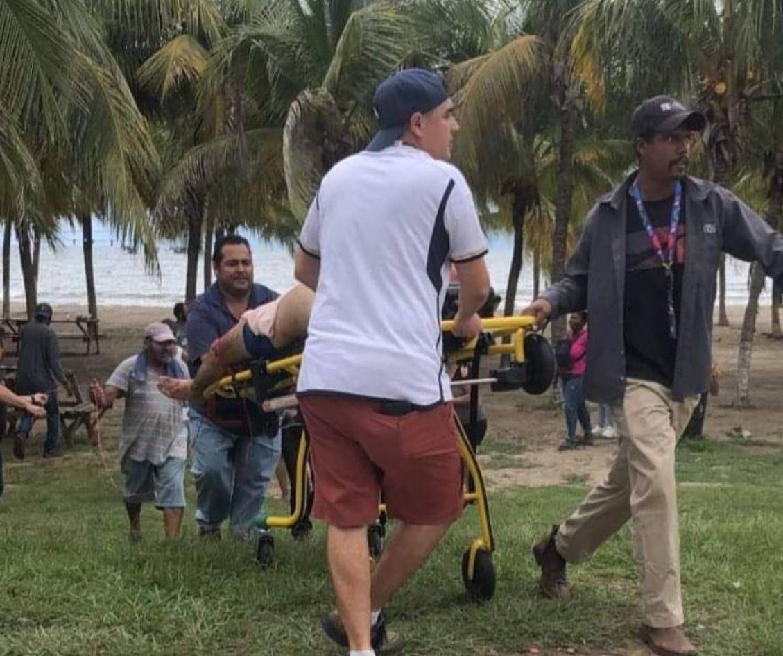 Hombre sufre feroz ataque de tiburón en la playa de Tela, Atlántida