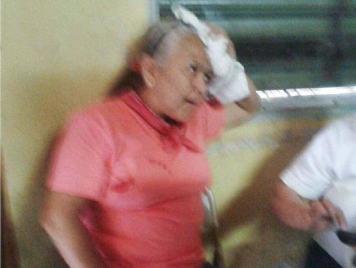 Honduras: Un herido en ataque a bus de Mi Esperanza