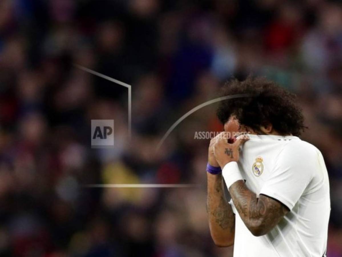 Marcelo sufre una 'lesión muscular' en la pierna derecha 