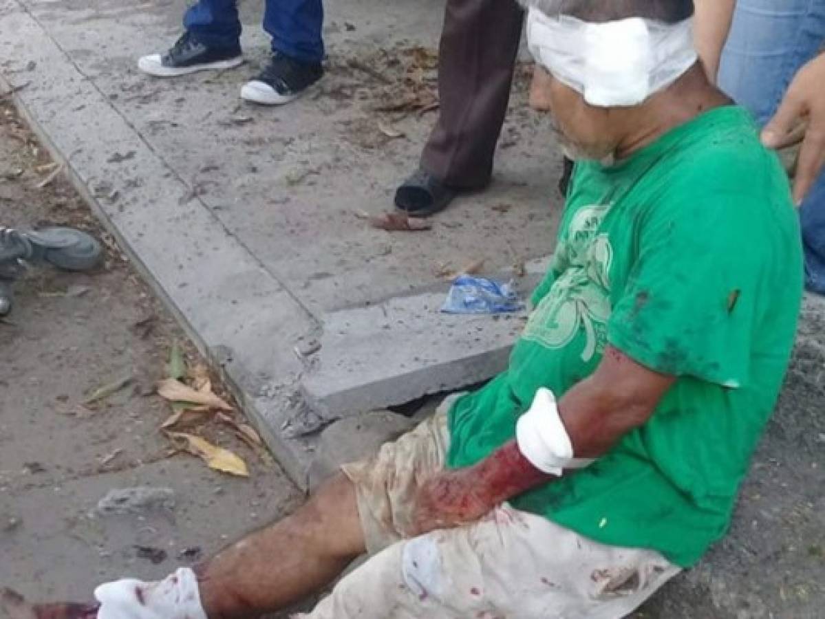 Adulto mayor pierde una oreja al ser atacado por tres perros en San Pedro Sula