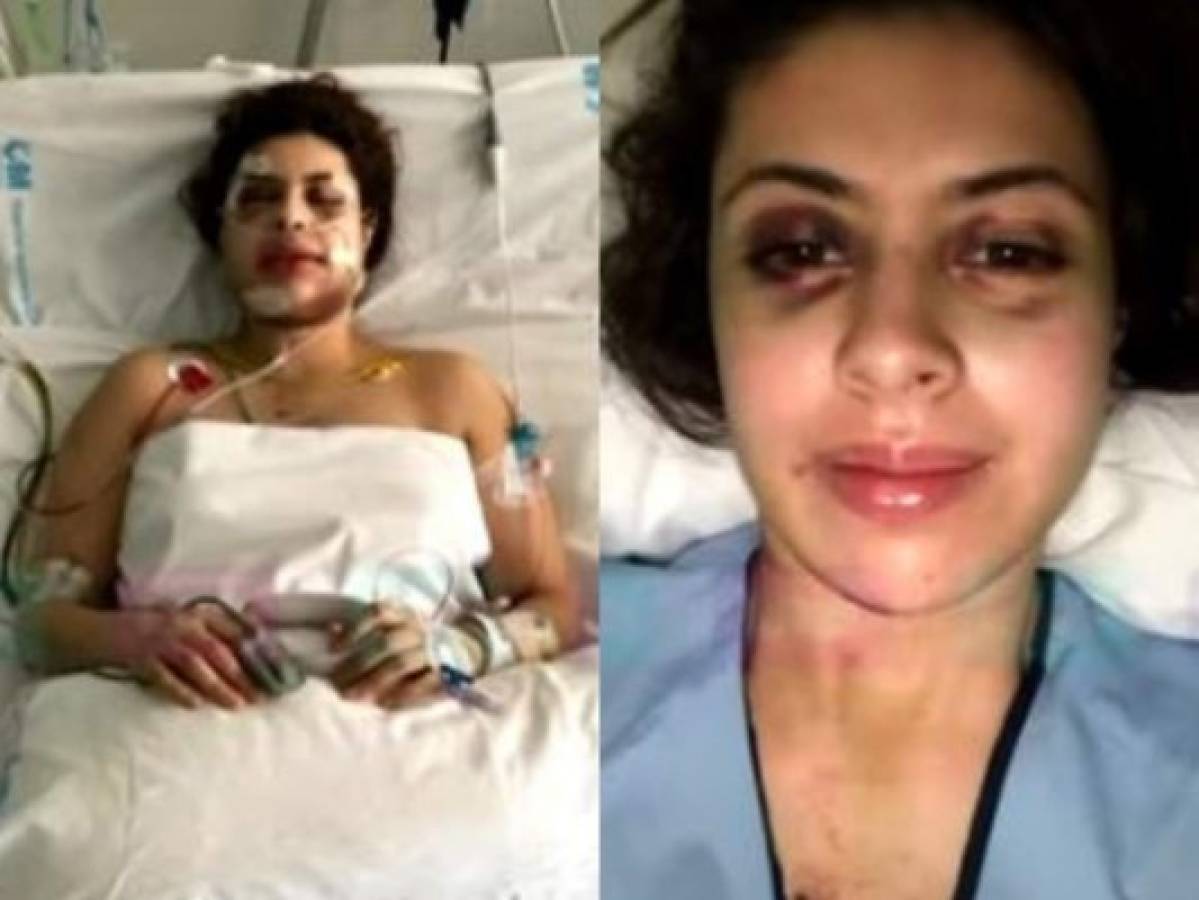 Cantante Naela se recupera tras sufrir 47 fracturas en su rostro