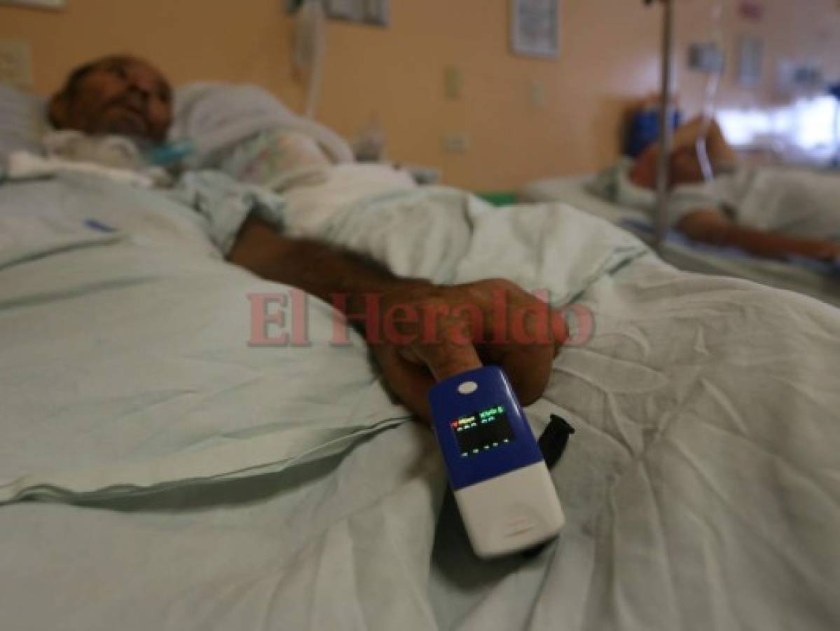 Honduras: Hay 84 personas afectadas con Guillain-Barré en lo que va de 2018