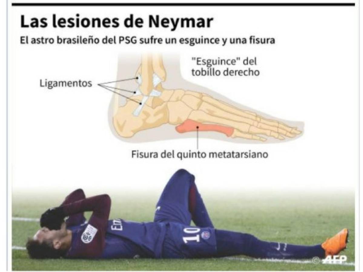 Neymar 'será operado al final de la semana en Brasil', revela el PSG