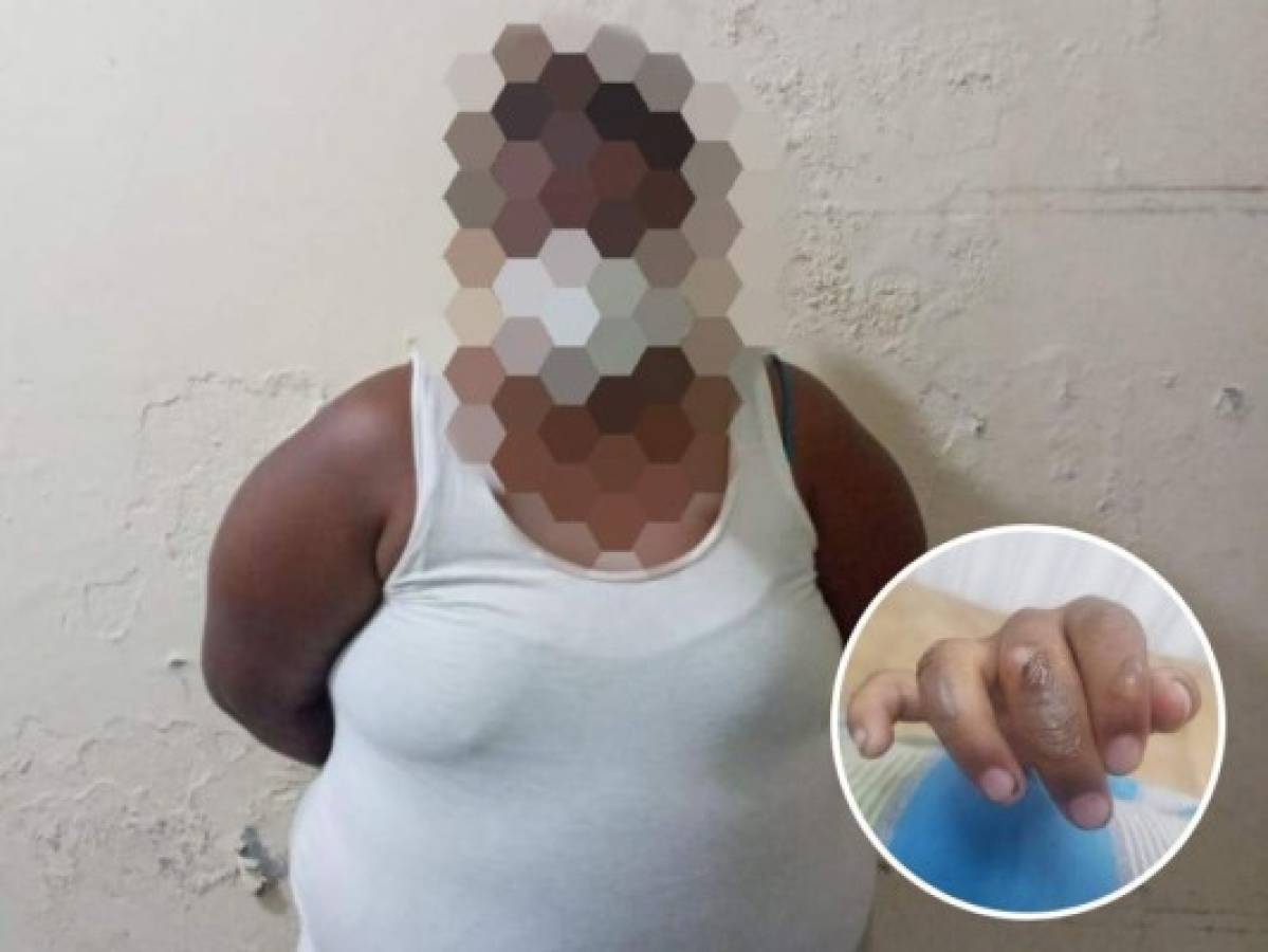 A la cárcel envían a mujer que quemó las manos de su hijo en Choluteca