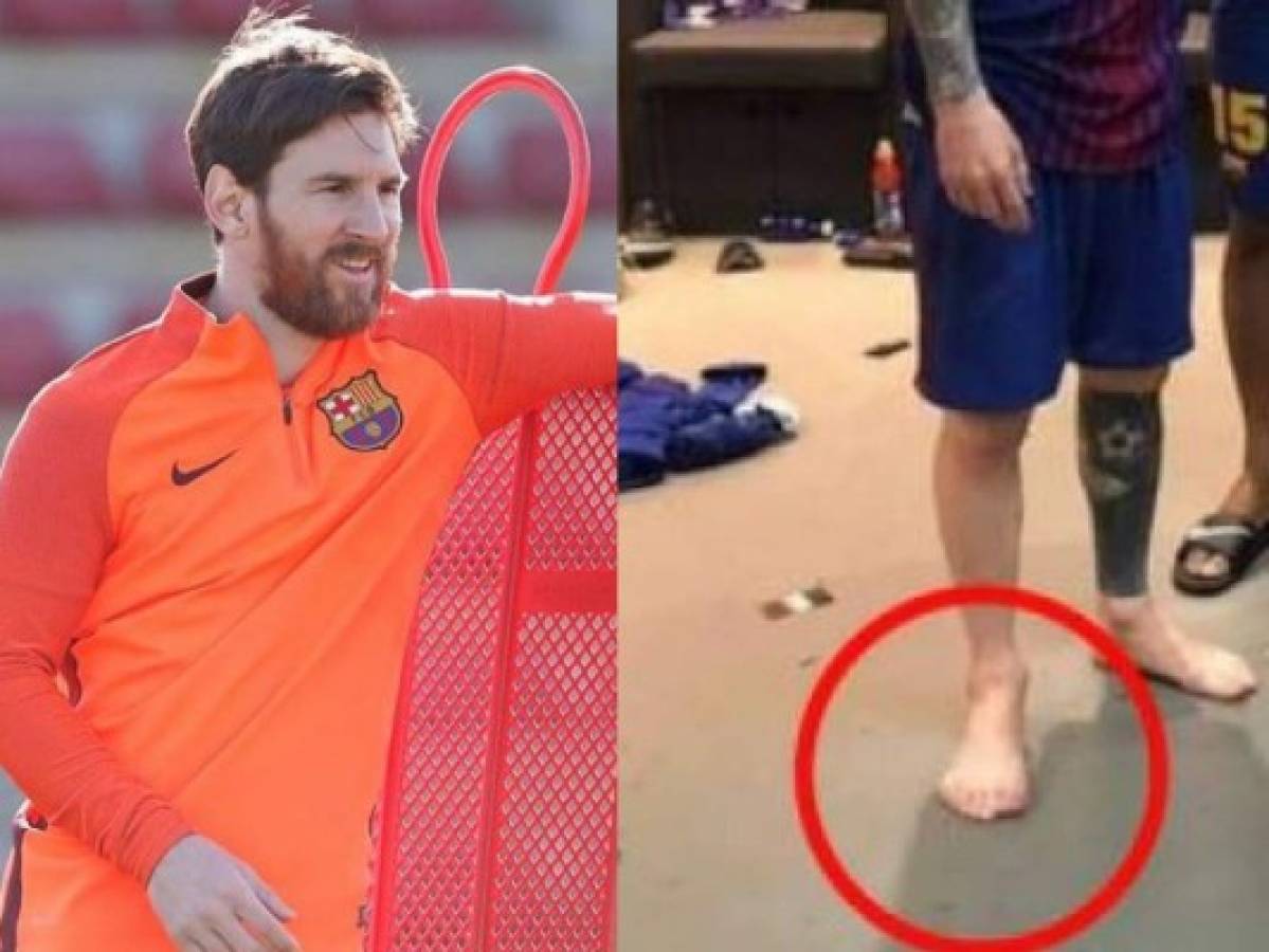 ¿Messi tiene seis dedos en el pie derecho? Imagen del argentino se vuelve viral