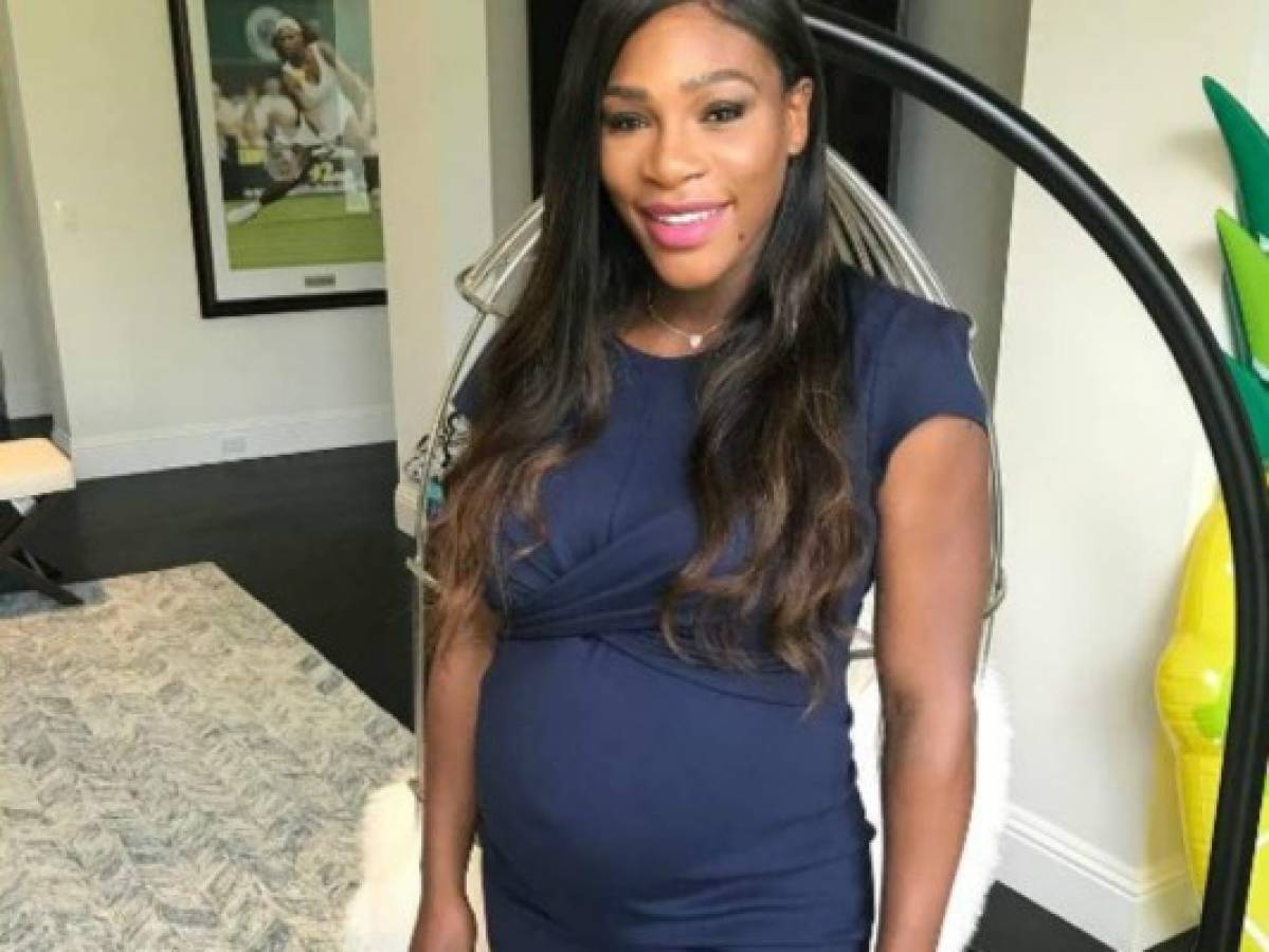 Serena Williams confiesa que hubo complicaciones en el parto de su hija