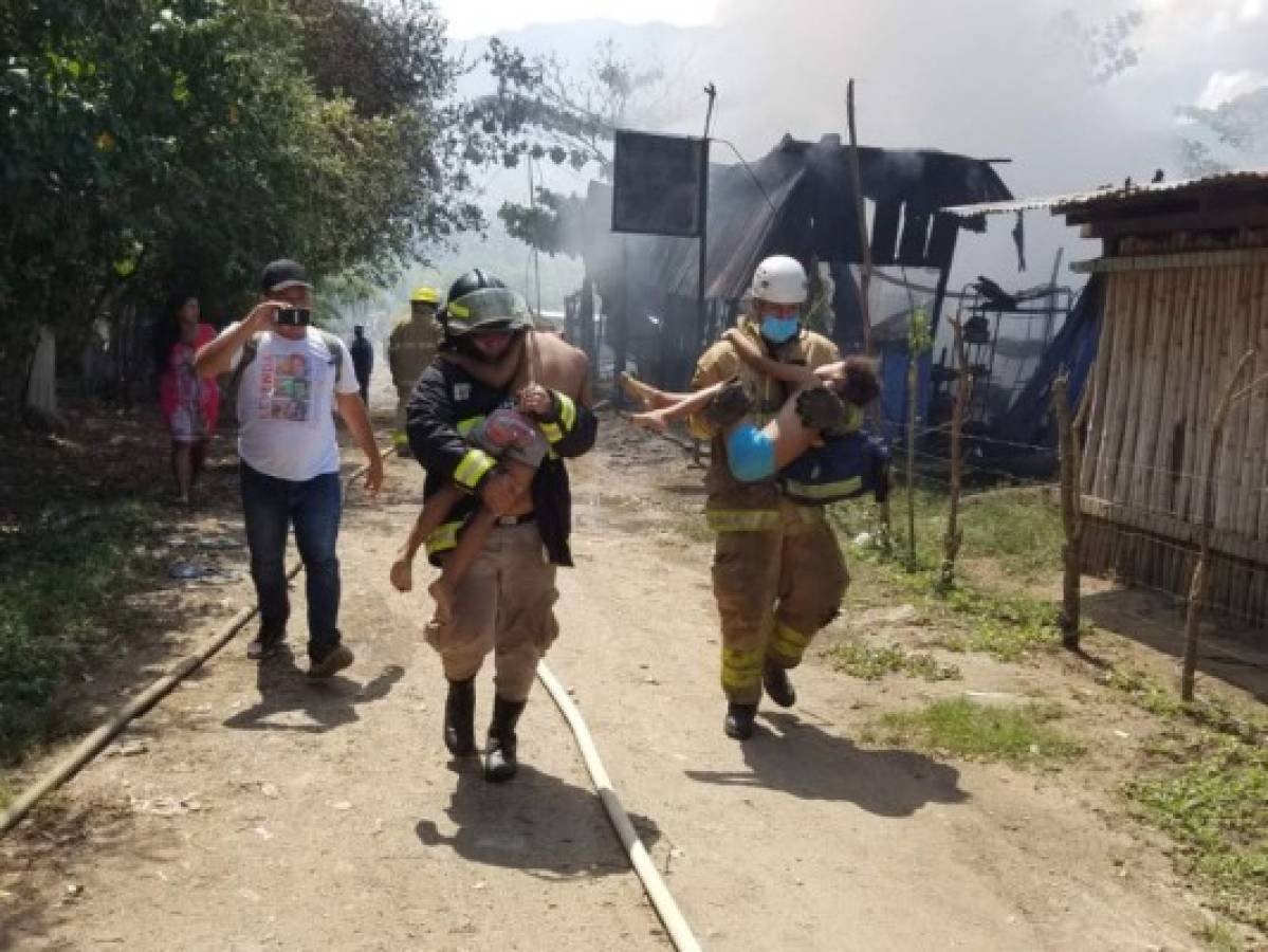 Muere menor que había sido rescatado de voraz incendio en El Progreso