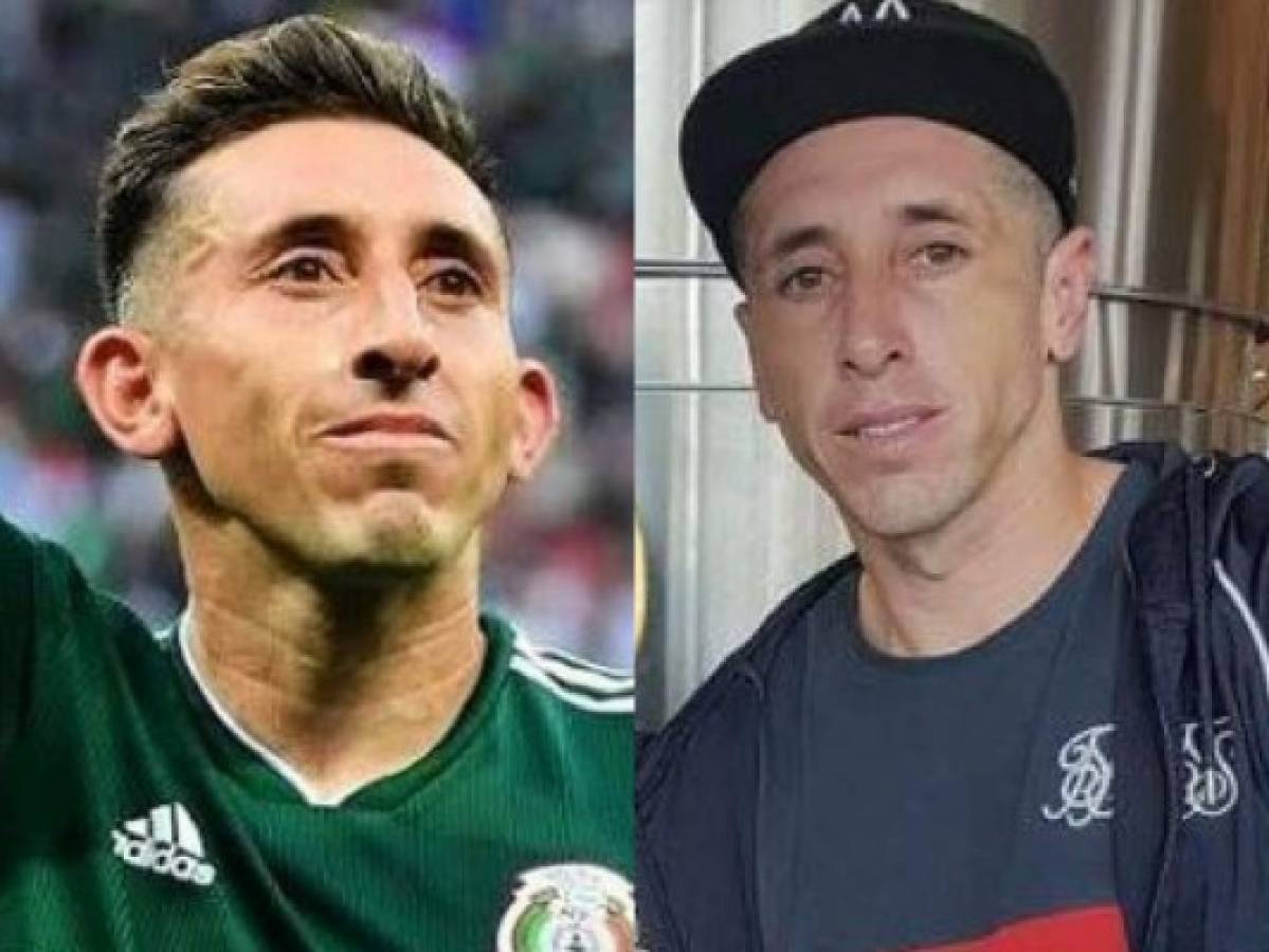 Héctor Herrera luce nuevo rostro tras operarse la nariz y las orejas