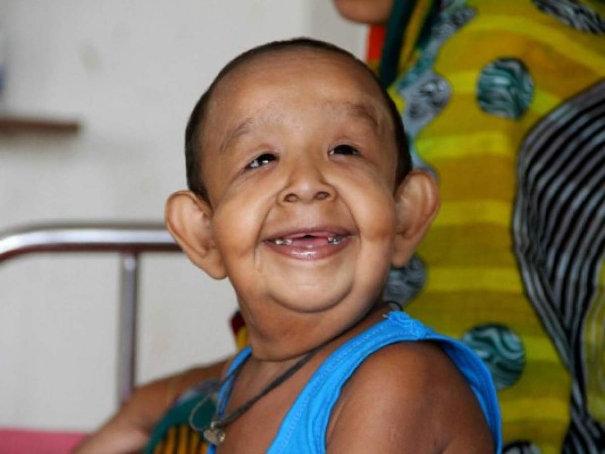 Salvador tiene 2 años, padece una inusual enfermedad y sus padres