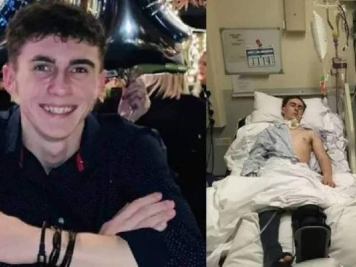 El caso de Joseph Flavill, el joven que estuvo en coma y se infectó de covid-19  