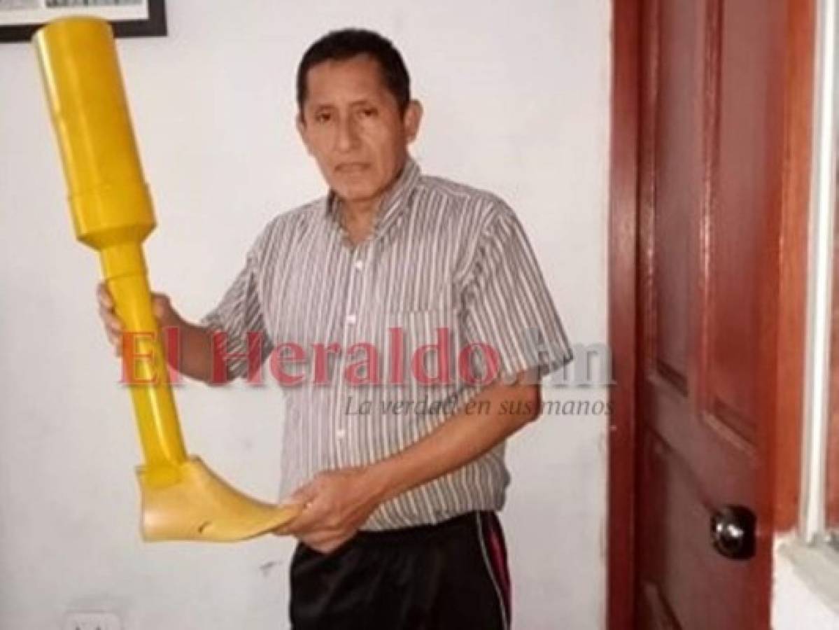 Otro de sus inventos consiste en las prótesis para piernas a base de plásticos, la cual asegura, ya está siendo utilizada por algunas personas. Foto: EL HERALDO