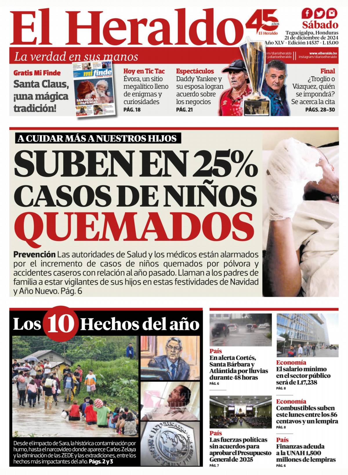 Suben en 25% casos de niños quemados