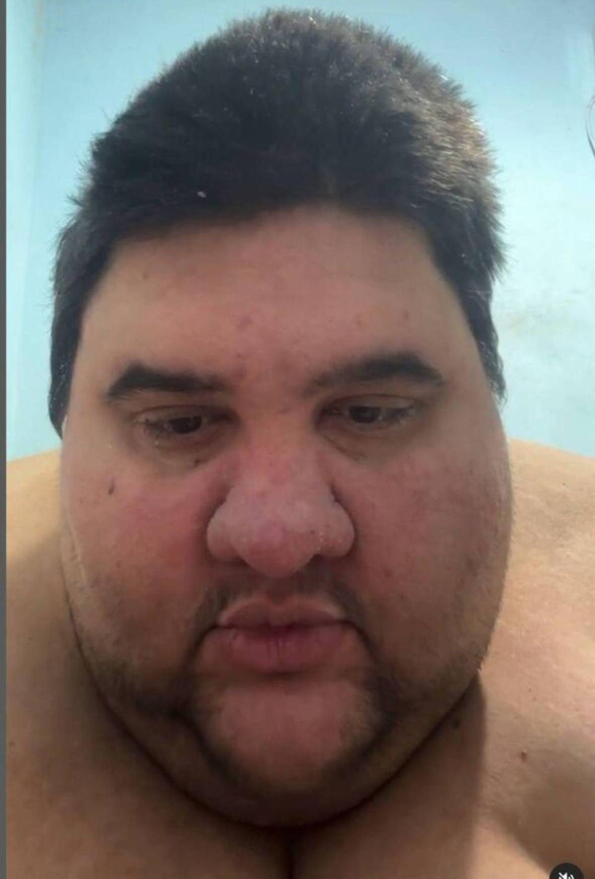 Muere Gabriel Freitas, el influencer brasileño que luchó contra la obesidad