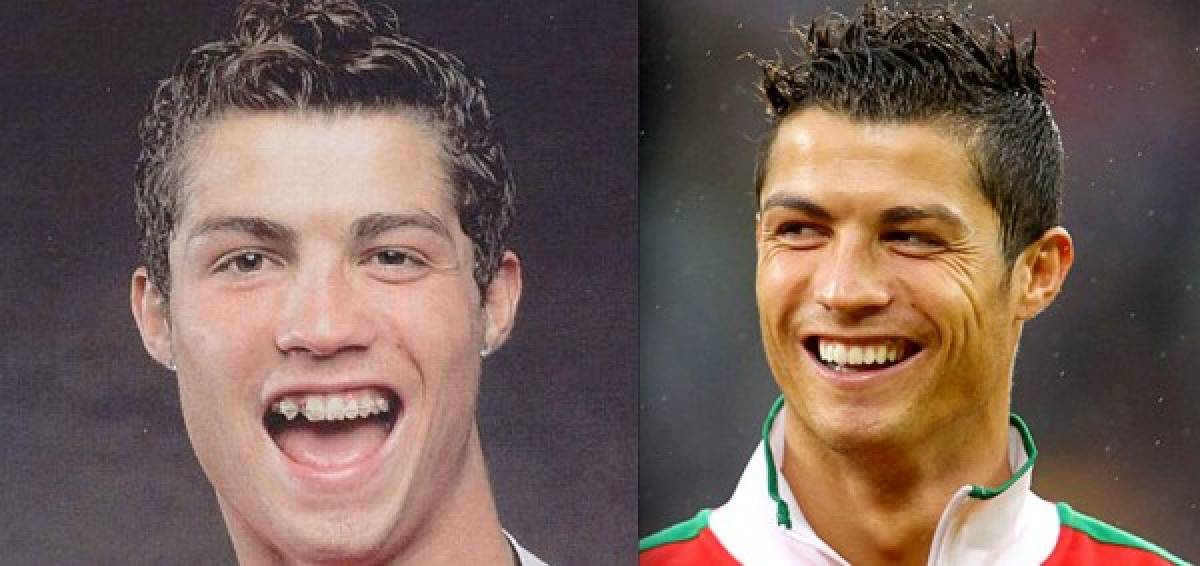 VIDEO: Evolución del rostro de Cristiano Ronaldo