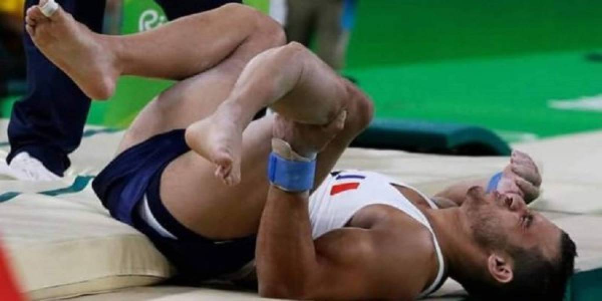 Gimnasta francés sufre grave lesión durante clasificación masculina en Juegos de Rio