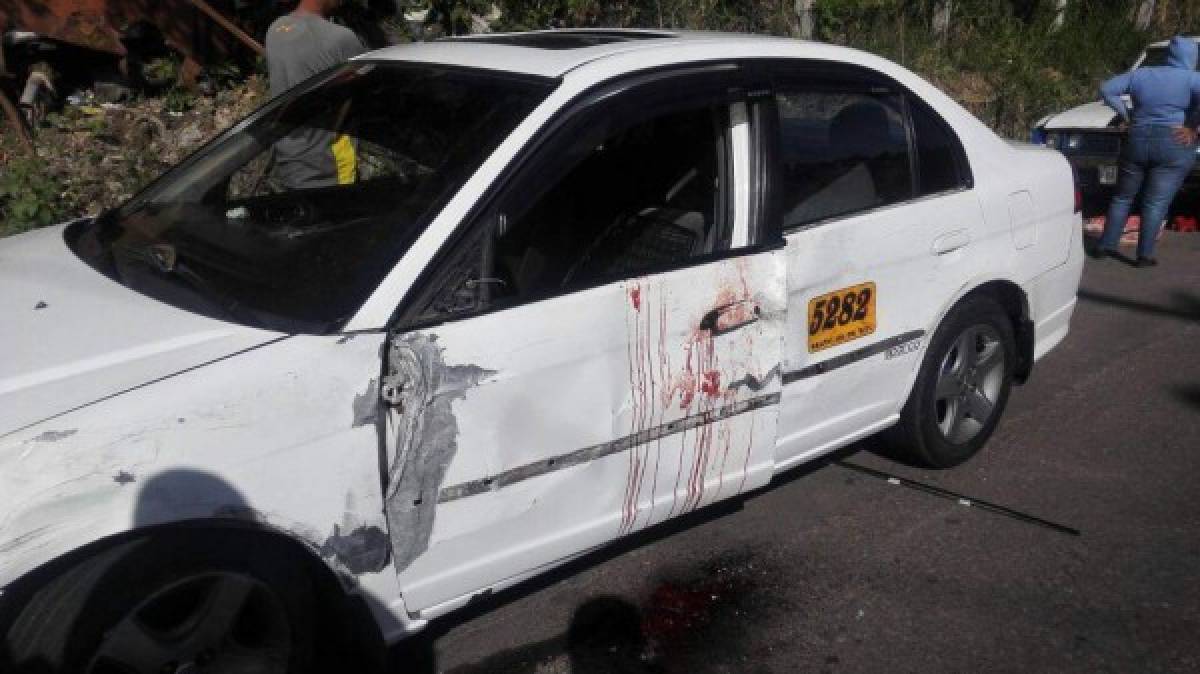 Honduras: Taxista casi pierde su brazo derecho al impactar contra autobús