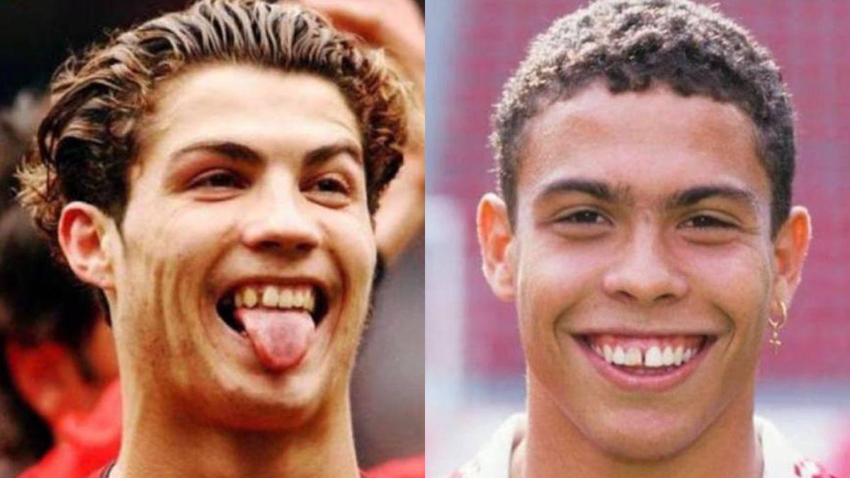 dientes de cristiano ronaldo