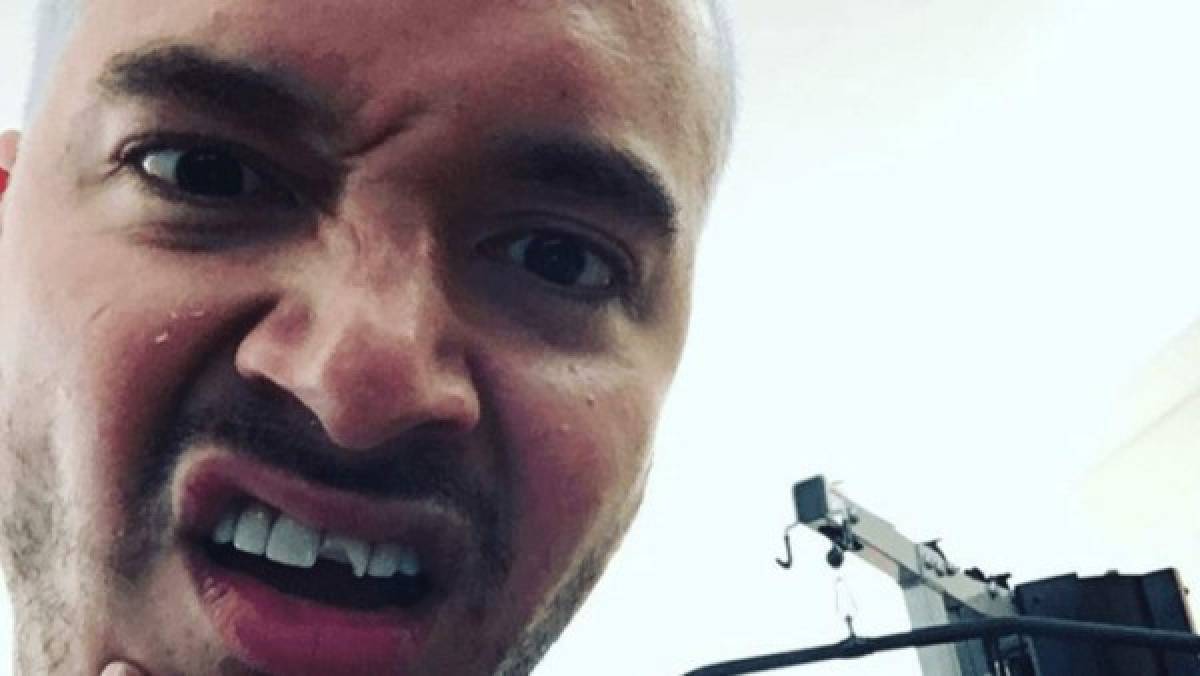 J Balvin se quebró un diente y lo tomó con humor