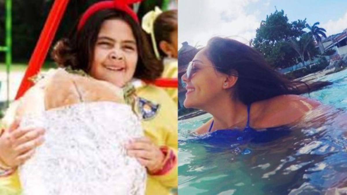 Mira el increíble antes y después de 'Polita' a sus 21 años