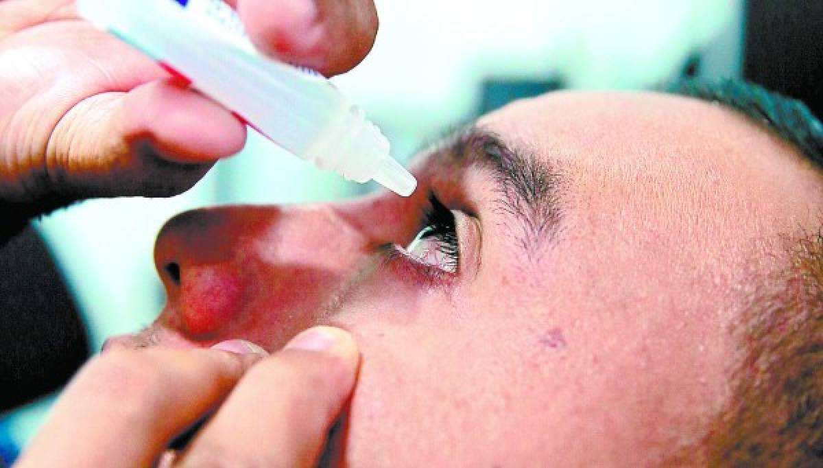 Poco control en las fronteras causó alza de conjuntivitis en Honduras