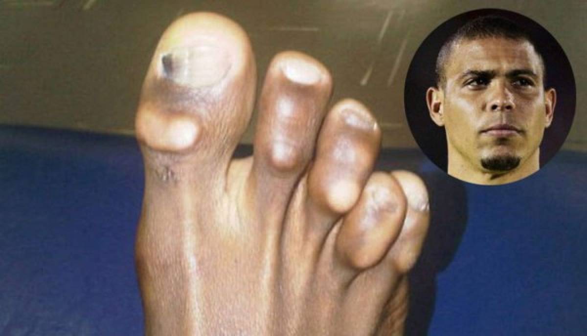 ¡Horribles! Así son los pies de las estrellas del fútbol