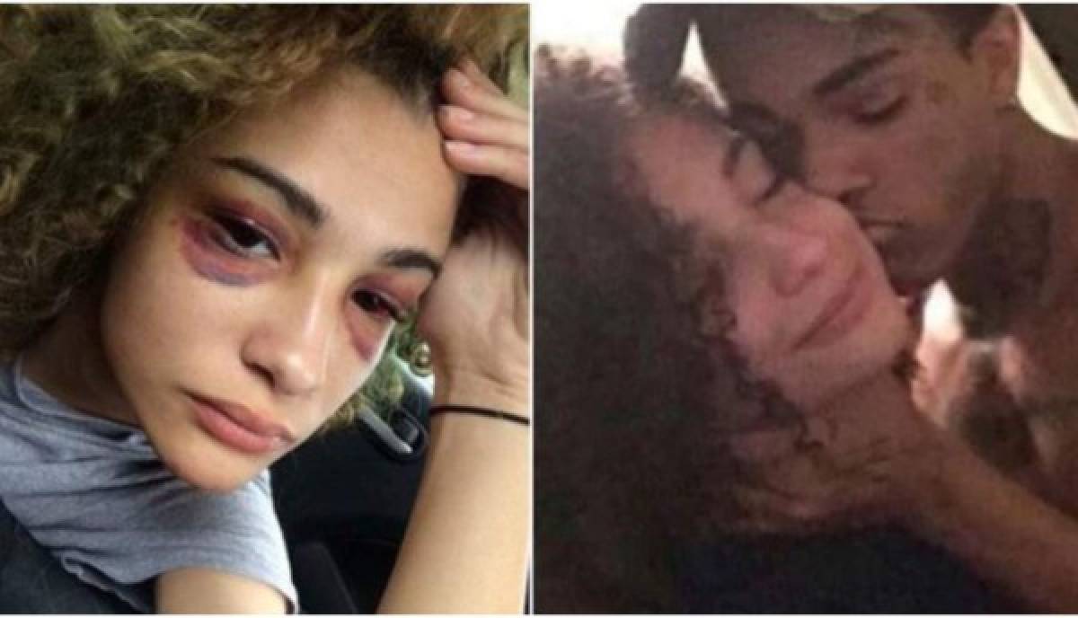 Ex novia de XXXTentacion revela las brutales golpizas que le daba el rapero