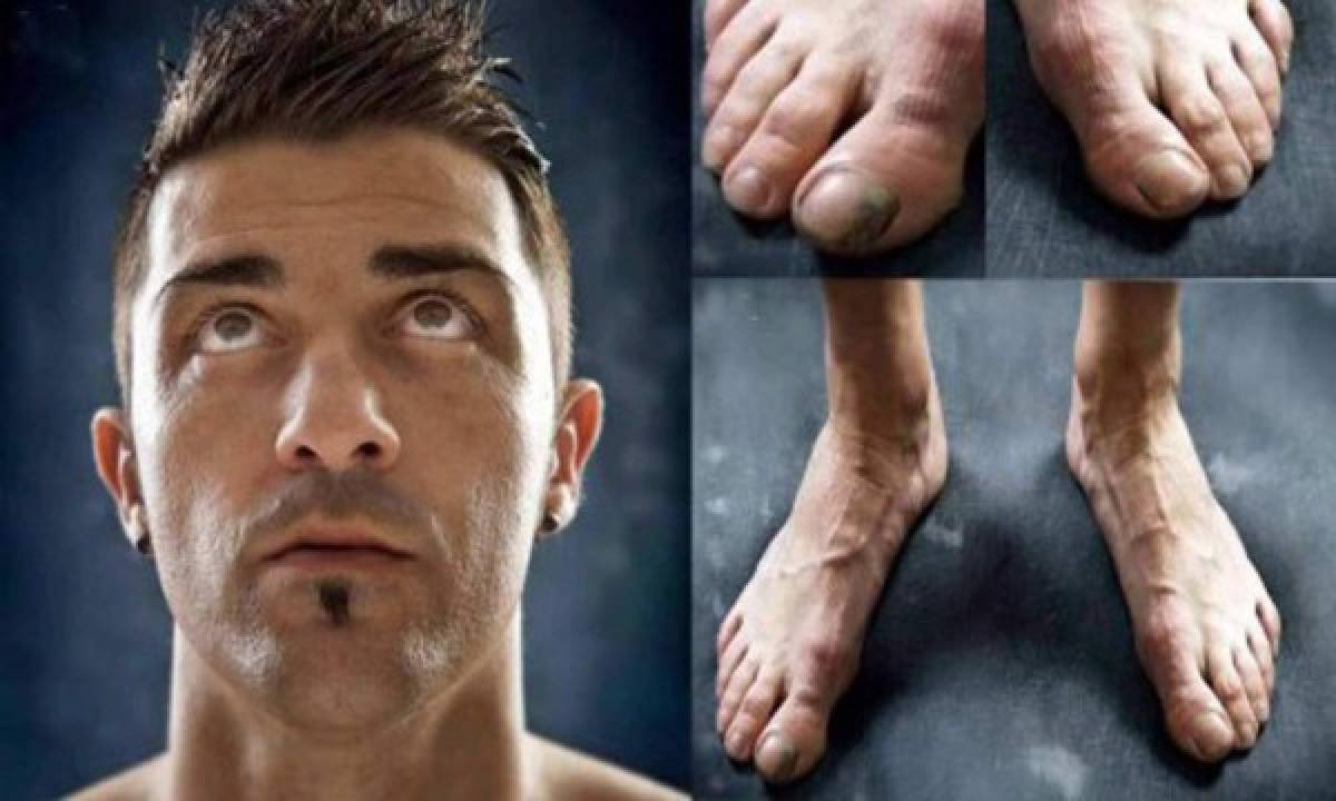 ¡Horribles! Así son los pies de las estrellas del fútbol