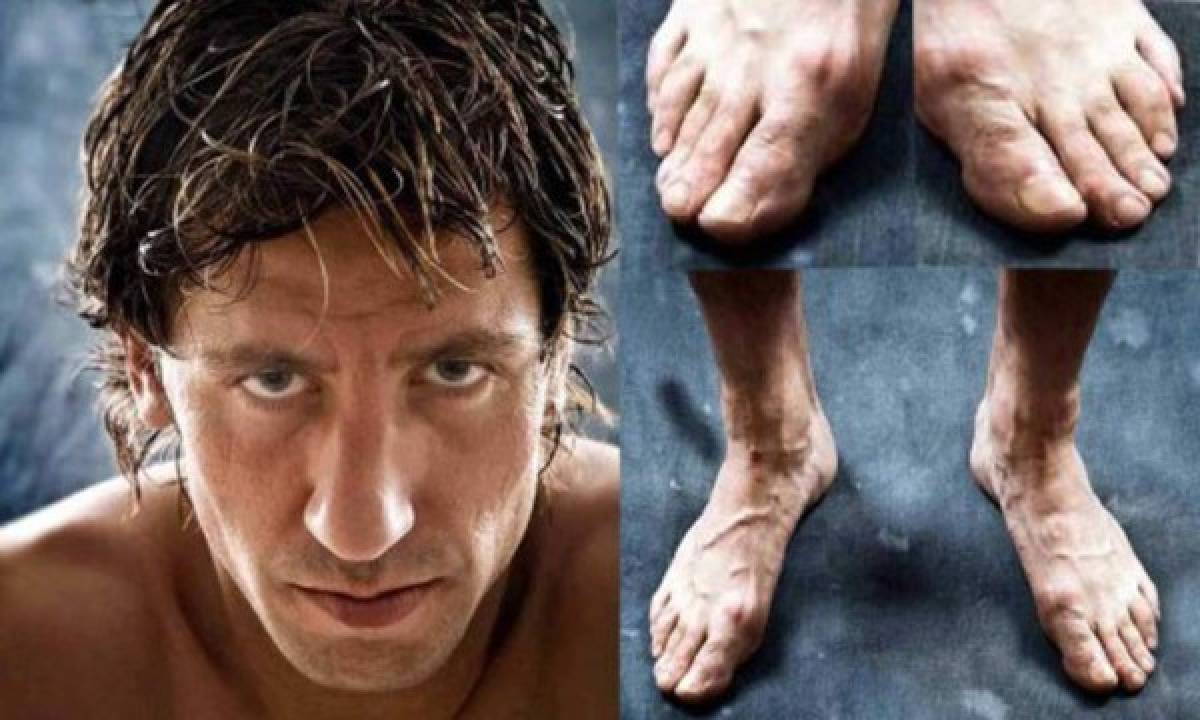 ¡Horribles! Así son los pies de las estrellas del fútbol