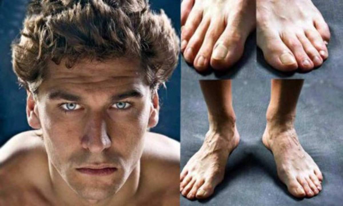 ¡Horribles! Así son los pies de las estrellas del fútbol