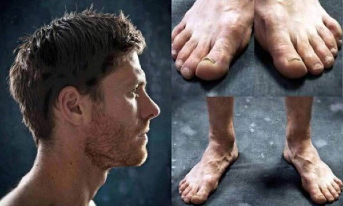 ¡Horribles! Así son los pies de las estrellas del fútbol