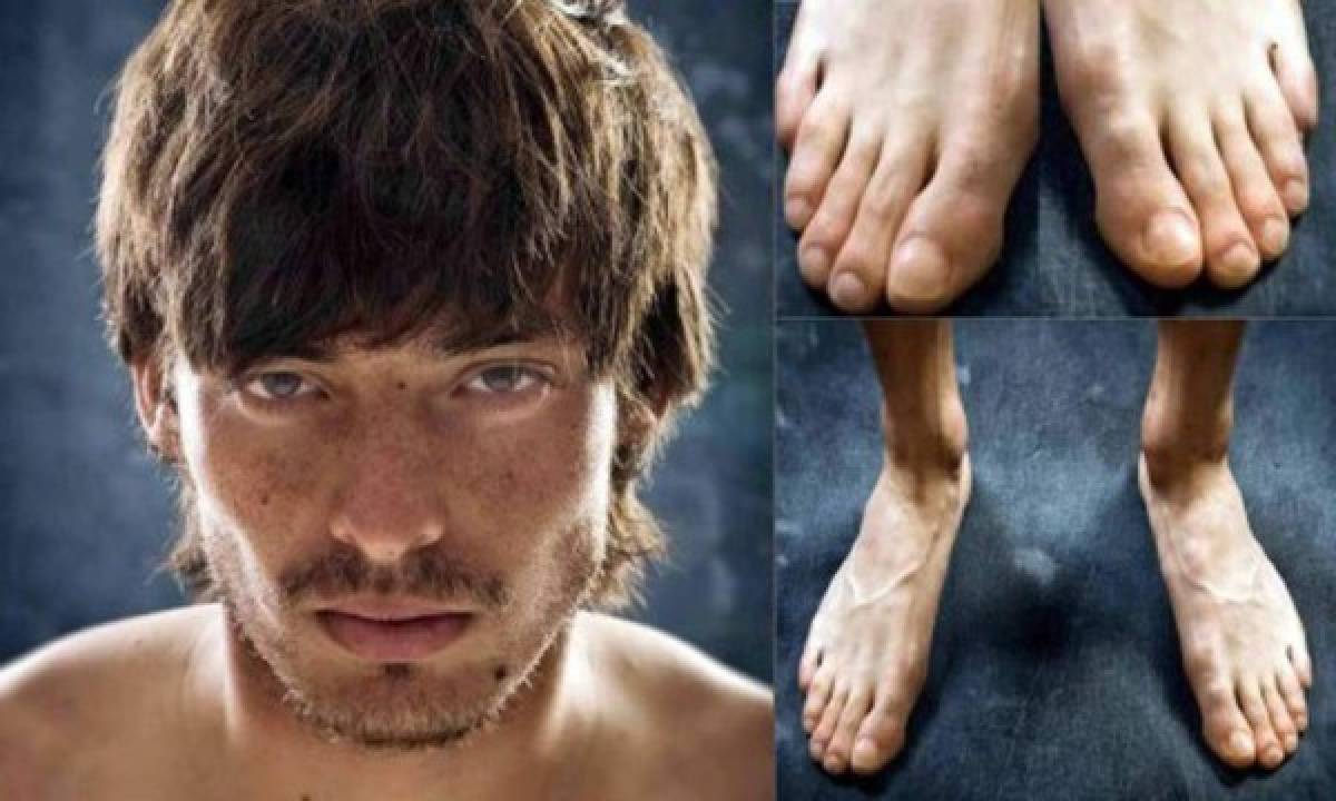 ¡Horribles! Así son los pies de las estrellas del fútbol