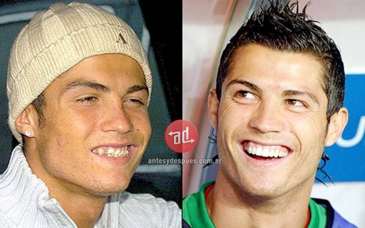 VIDEO: Evolución del rostro de Cristiano Ronaldo