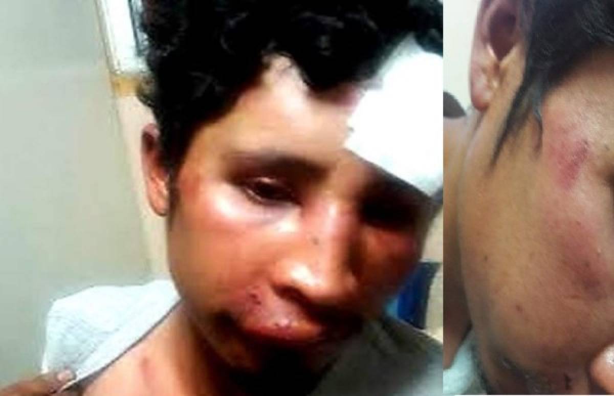 Migrante hondureño es golpeado por agente de migración en México