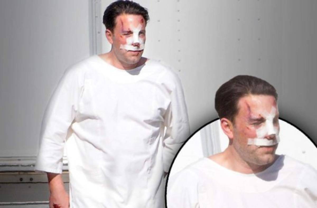 ¿Qué le pasó en la cara a Ben Affleck? ¿El actor se operó el rostro? (FOTOS)