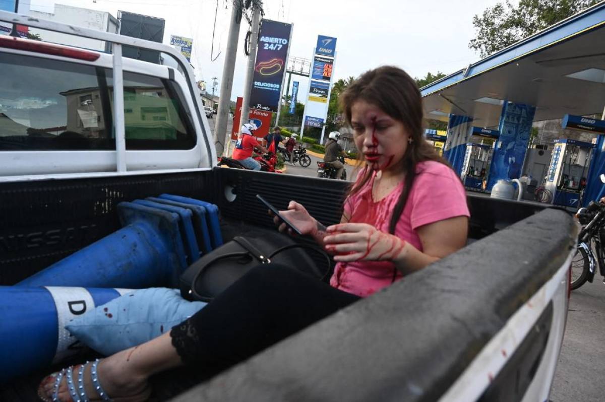 Momento en que la mujer agredida es trasladada en un vehículo.