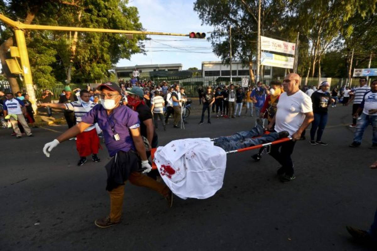 Represión del miércoles deja 15 muertos y 199 heridos en Nicaragua