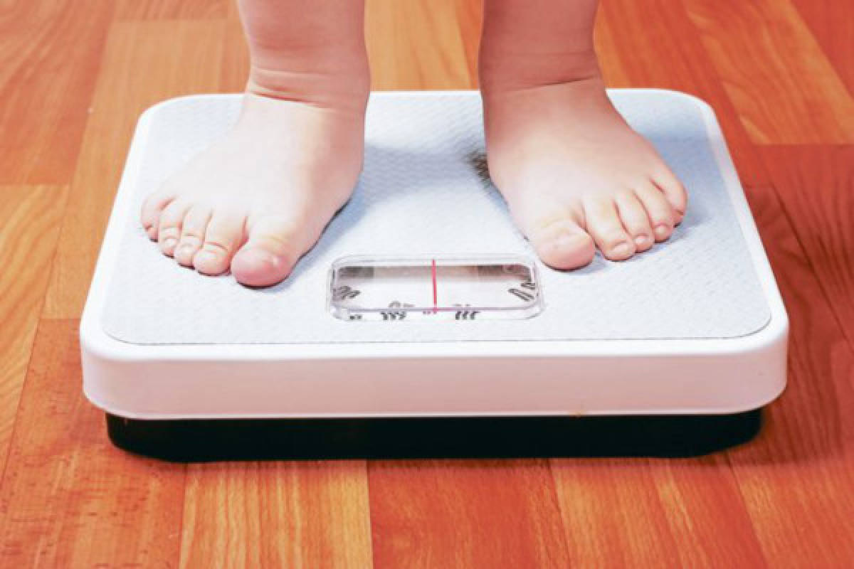 Obesida infantil y sus riesgo para el riñón